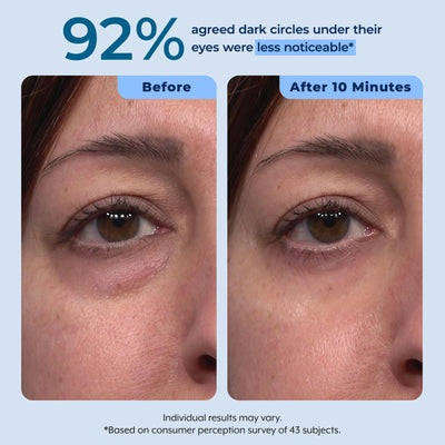 Plexaderm Rapid Reduction Serum - Visibly Reduces Under-Eye Bags & Wrinkles