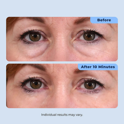 Plexaderm Rapid Reduction Serum - Visibly Reduces Under-Eye Bags & Wrinkles