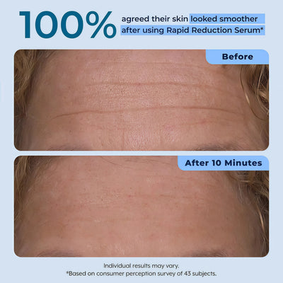 Plexaderm Rapid Reduction Serum - Visibly Reduces Under-Eye Bags & Wrinkles