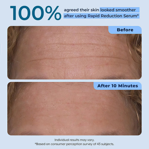 Plexaderm Rapid Reduction Serum - Visibly Reduces Under-Eye Bags & Wrinkles